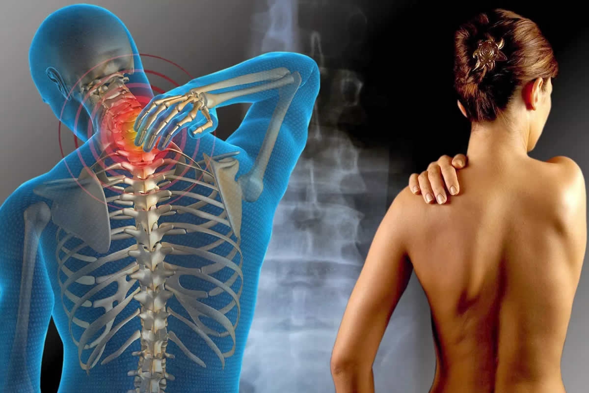 A S&iacute;ndrome da Fibromialgia