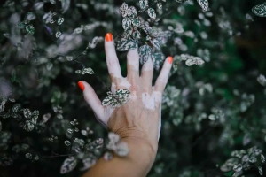Vitiligo